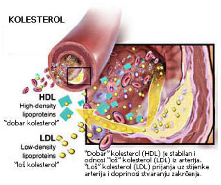 kolsterol ldl hdl